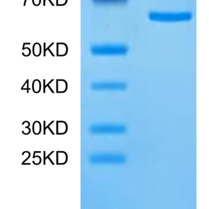SDS-PAGE gel of Human Tulp1 Protein 2726