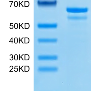 SDS-PAGE gel of Human Tubby Protein 2731