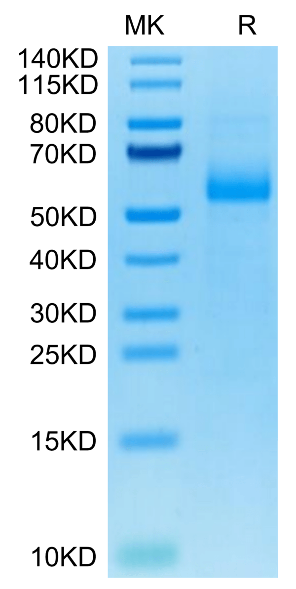 SDS-PAGE gel of Cynomolgus AGER Protein 2733