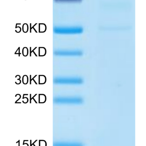 SDS-PAGE gel of Human MASP3 Protein 2736