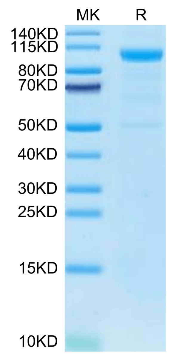 SDS-PAGE gel of Human MASP3 Protein 2736