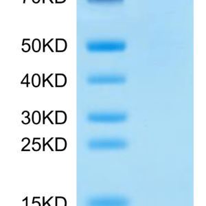 SDS-PAGE gel of Mouse ENPP-1 Protein 2745
