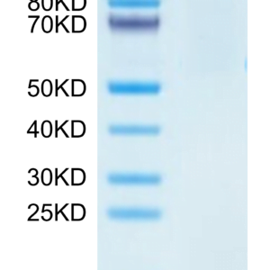 SDS-PAGE gel of Human HLA-A*02:01&B2M&HPV 16 E6 (KLPQLCTEL) Tetramer Pr 2748
