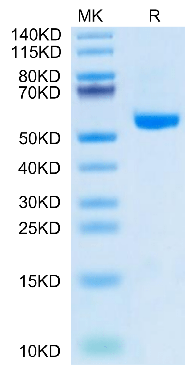 SDS-PAGE gel of Human HLA-A*02:01&B2M&HPV 16 E6 (KLPQLCTEL) Monomer Pro 2749