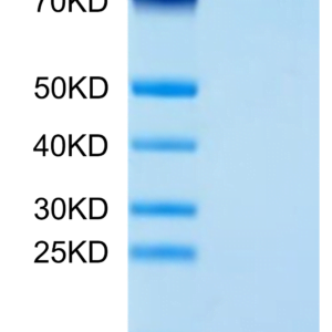 SDS-PAGE gel of Human LEPR Protein 2760