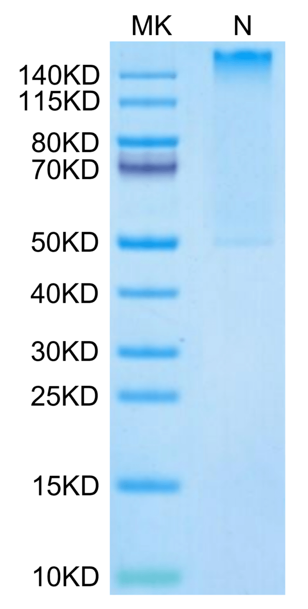 SDS-PAGE gel of Human HLA-A*02:01&B2M&MART-1 (ELAGIGILTV) Tetramer Prot 2761