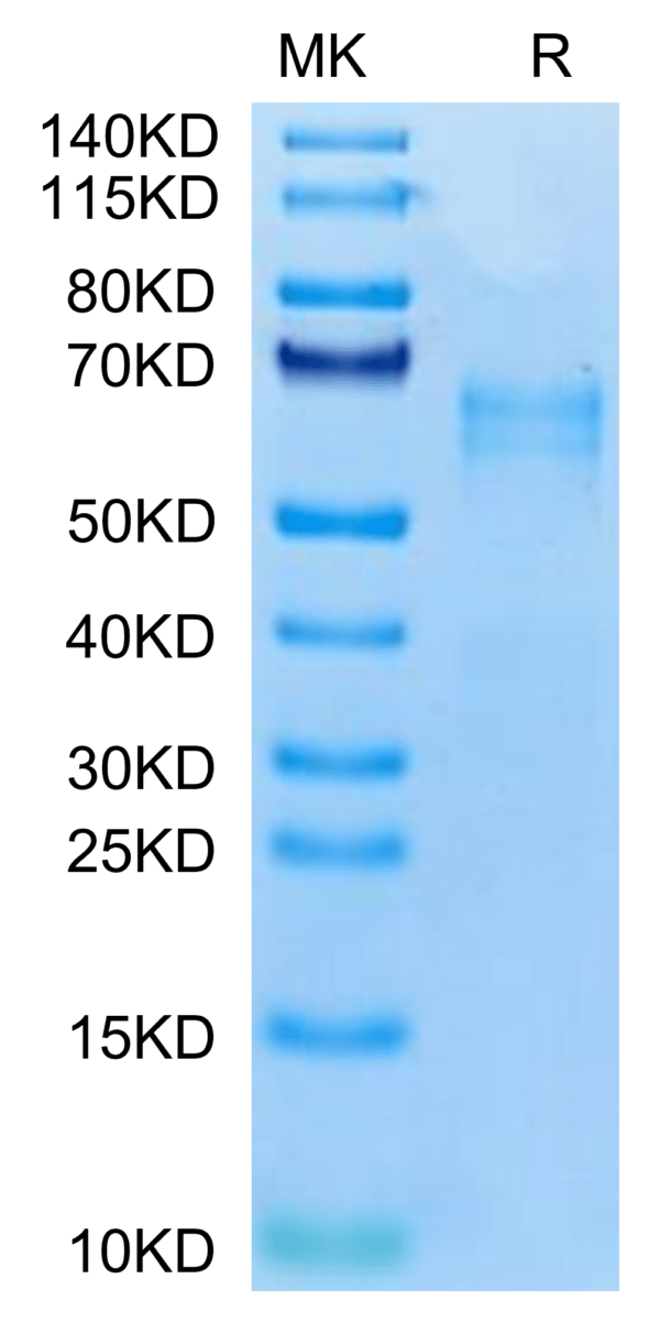 SDS-PAGE gel of Human LTK protein 2766