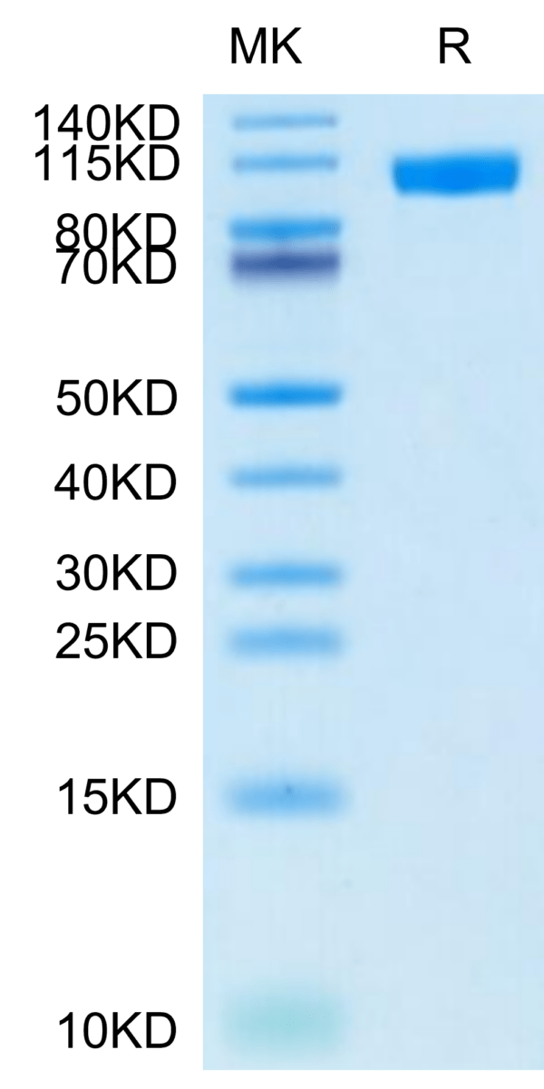 SDS-PAGE gel of Cynomolgus NCAM-1/CD56 Protein 2773