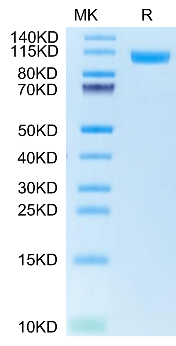 SDS-PAGE gel of Human NCAM-1/CD56 Protein 2780