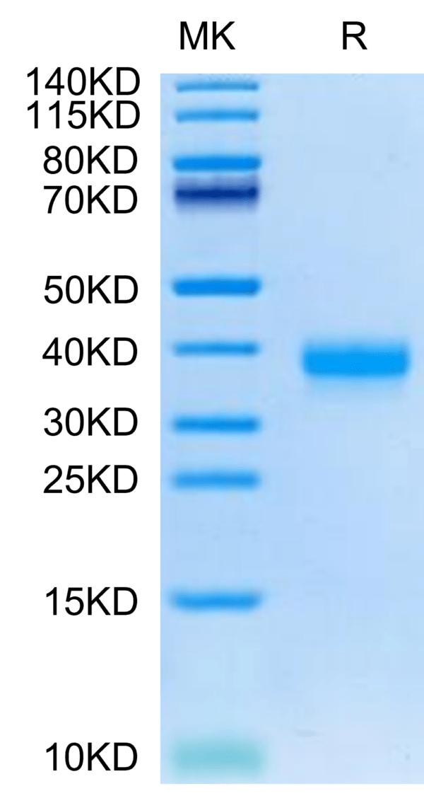 SDS-PAGE gel of Cynomolgus ANGPTL4/Angiopoietin-like 4 Protein 2794
