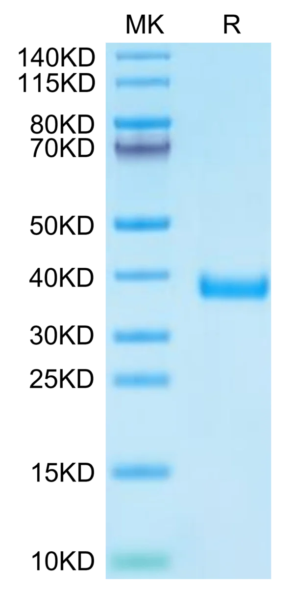 SDS-PAGE gel of Cynomolgus MFAP4 Protein 2845