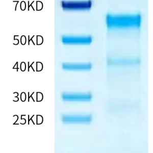SDS-PAGE gel of Human TENM2 Protein 2877