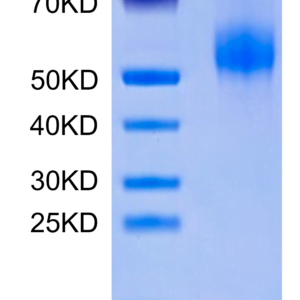 SDS-PAGE gel of Human CDH17/Cadherin 17 Domain 5-7 Protein 2883