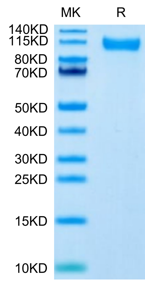 SDS-PAGE gel of SARS-CoV-2 Spike S1 (Delta B.1.617.2) Protein 2887