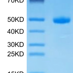 SDS-PAGE gel of Human CDH17/Cadherin 17 Domain 7 Protein 2904