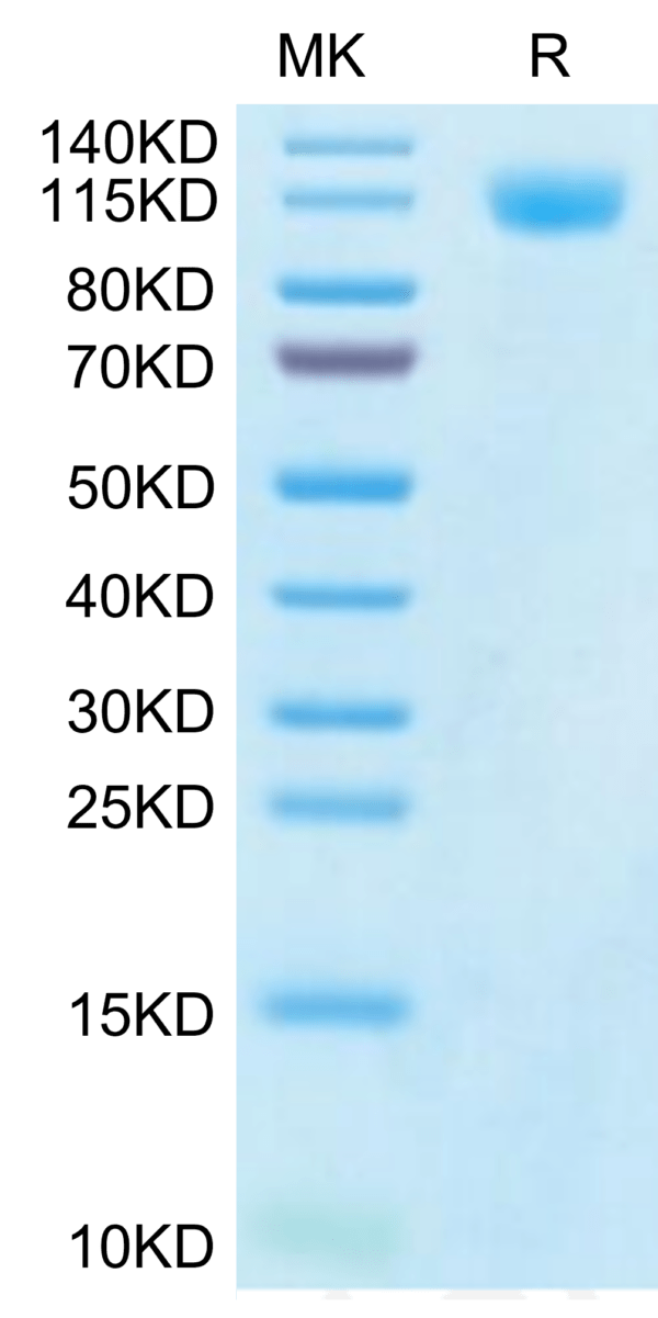 SDS-PAGE gel of SARS-CoV-2 Spike S1 (Gamma P.1/P.1.1/P.1.2) Protein 2908