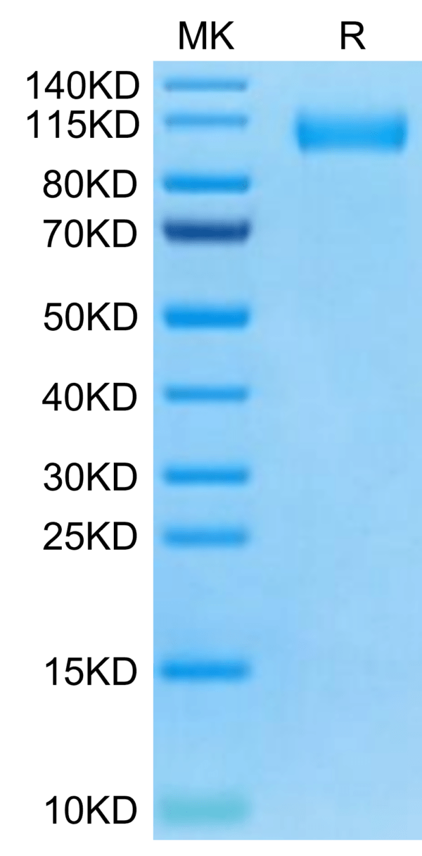 SDS-PAGE gel of SARS-CoV-2 Spike S1 (Omicron BA.4/BA.5/BA.5.2) Protein 2909