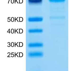 SDS-PAGE gel of Mouse CDH3/Cadherin 3 Protein 2923