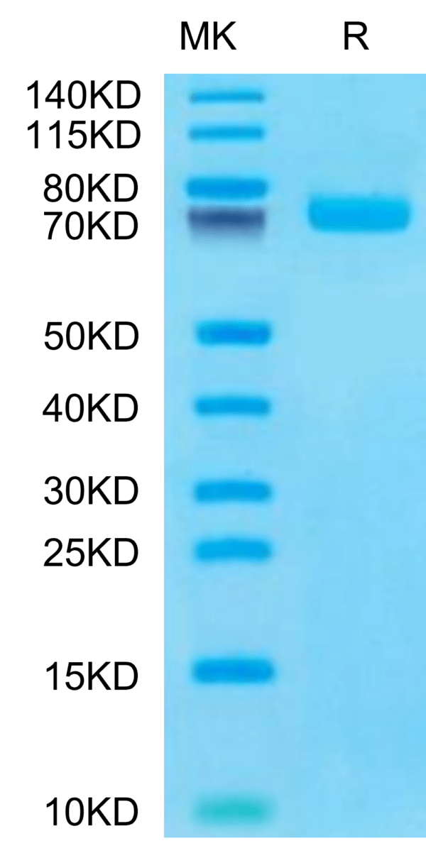 SDS-PAGE gel of Human BCAM Protein 2934