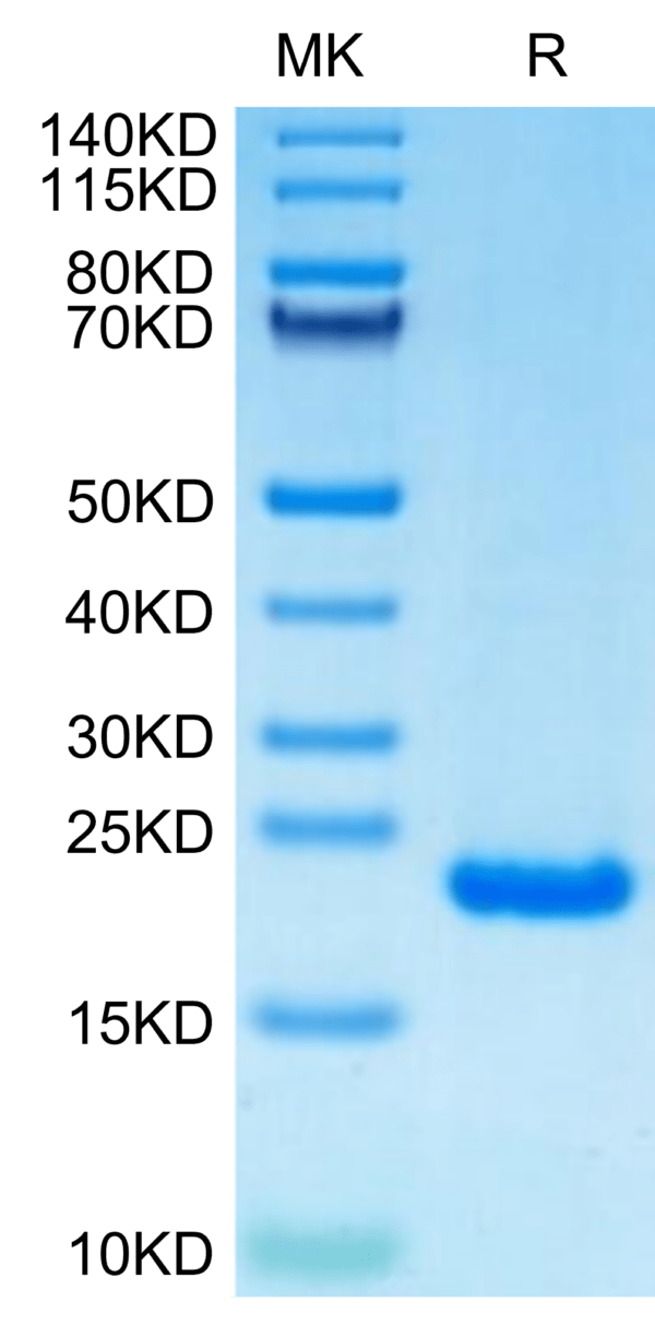 SDS-PAGE gel of Human PRL-2/PTP4A2 Protein 2941