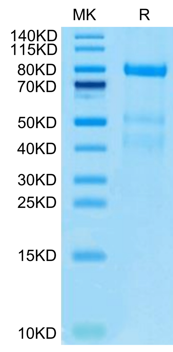 SDS-PAGE gel of Human Complement factor I Protein 2943