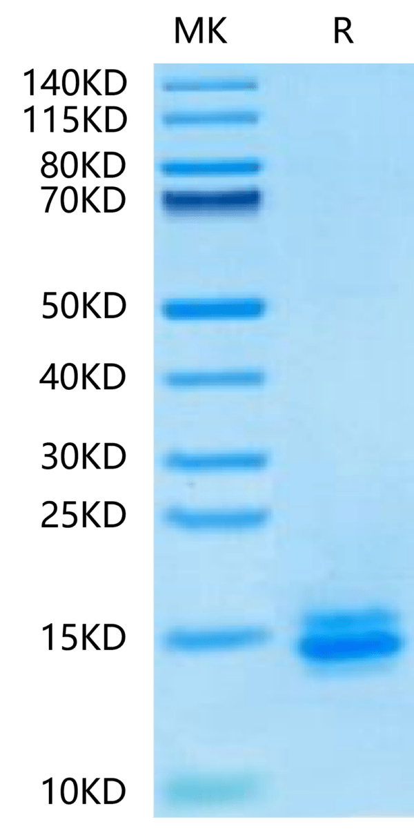 SDS-PAGE gel of Biotinylated Human LILRB4/CD85k/ILT3 Domain 1 Protein 2949