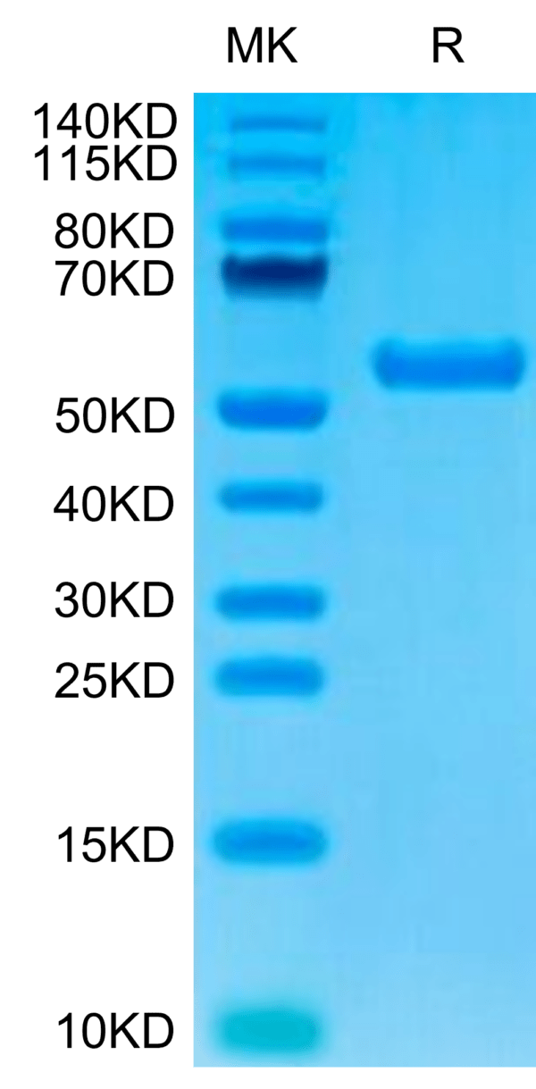 SDS-PAGE gel of Biotinylated Human HLA-A*02:01&B2M&AFP (FMNKFIYEI) Mono 2956