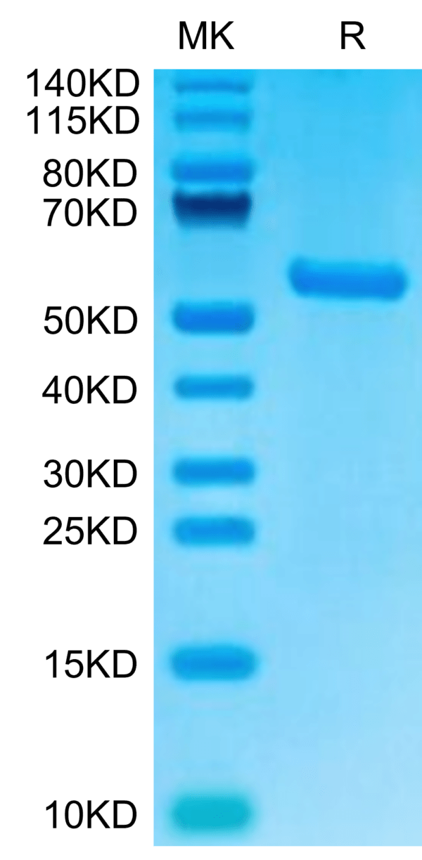 SDS-PAGE gel of Biotinylated Human HLA-A*02:01&B2M&AFP (PLFQVPEPV) Mono 2957