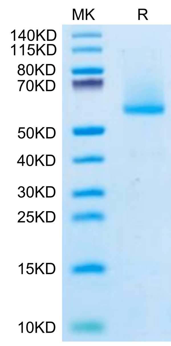 SDS-PAGE gel of Biotinylated Human FGF21 Protein 2962