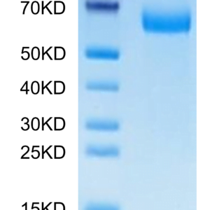 SDS-PAGE gel of Mouse Alkaline phosphatase (Intestinal type) /ALPI Prot 2976