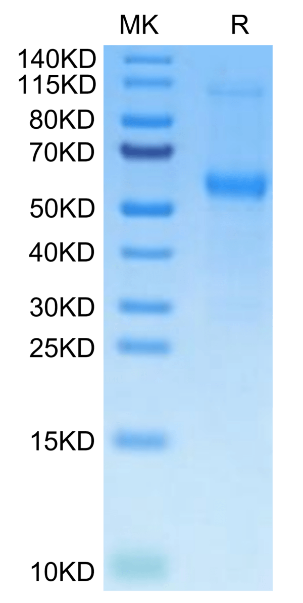 SDS-PAGE gel of Mouse TNFRSF11B Protein 2985