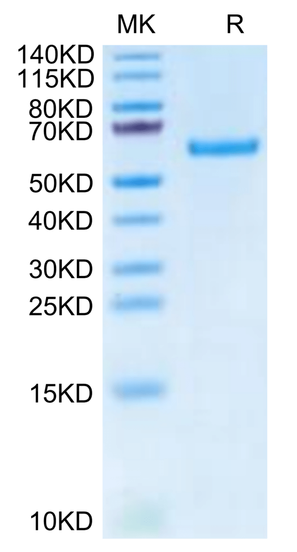 SDS-PAGE gel of Mouse TNFRSF11A/Rank Protein 2989