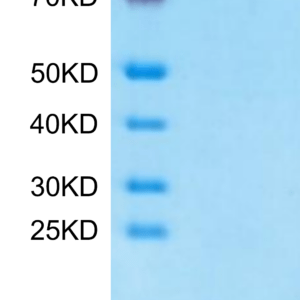 SDS-PAGE gel of Human Complement C5a Protein 3004