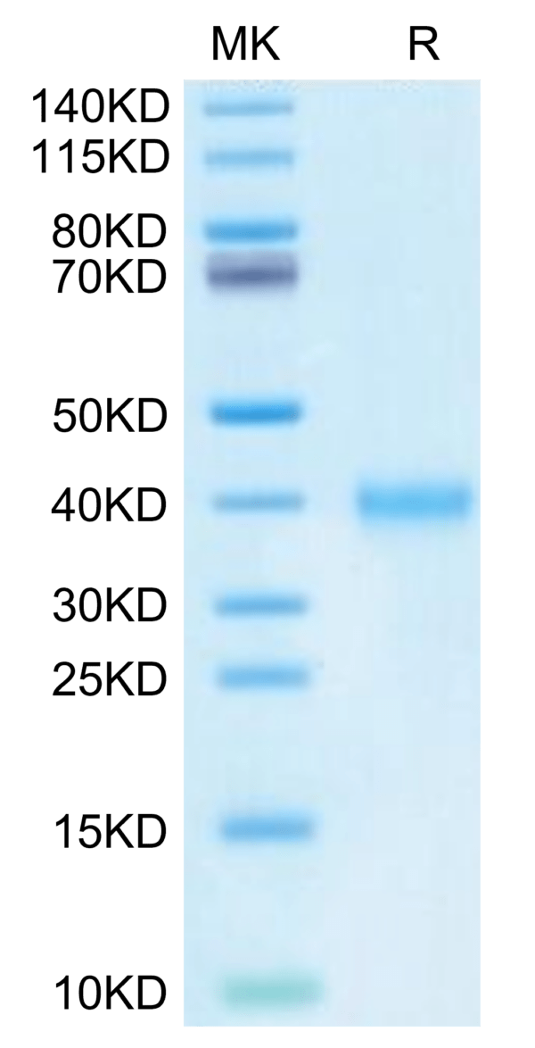 SDS-PAGE gel of Mouse IGSF11 Protein 3019