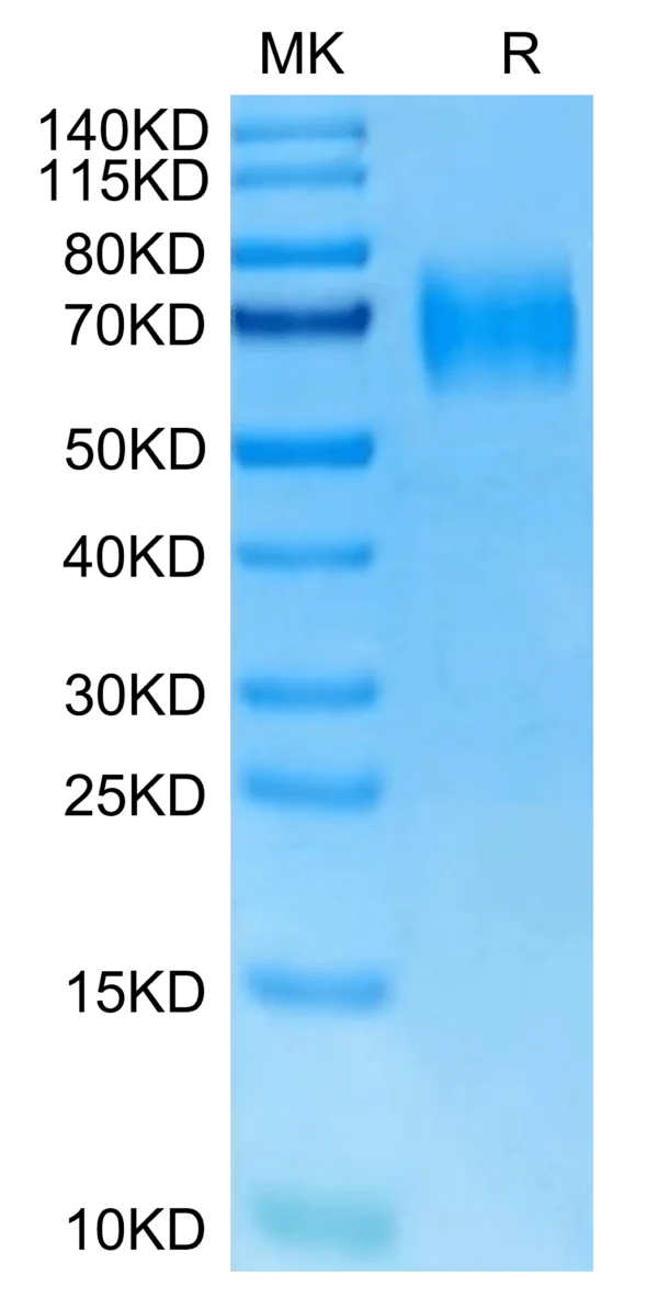 SDS-PAGE gel of Mouse IL-23R Protein 3040