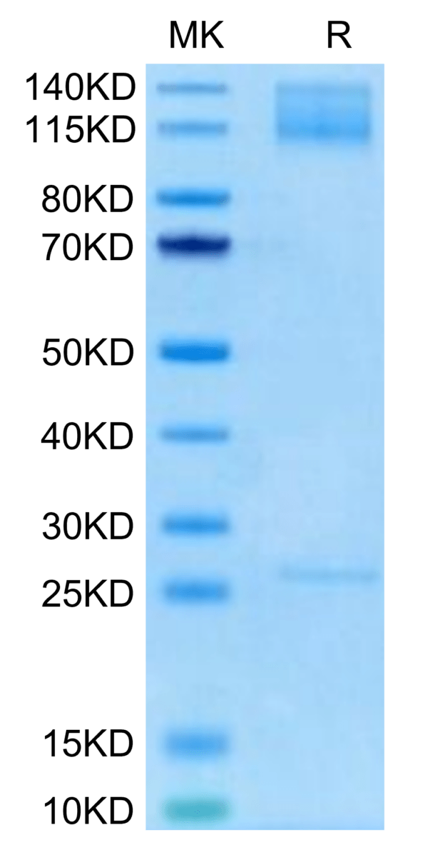 SDS-PAGE gel of Biotinylated Human Integrin alpha 5 beta 1 (ITGA5&ITGB1 3064