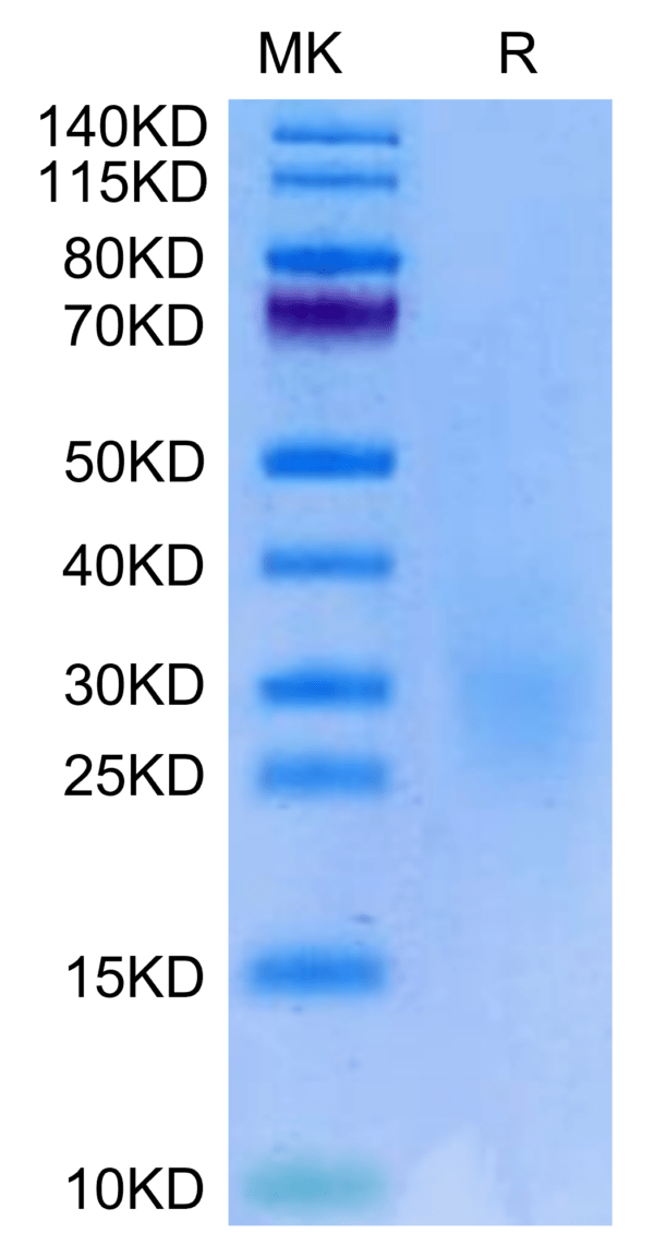 SDS-PAGE gel of Biotinylated Human NKG2C&CD94 Protein 3069