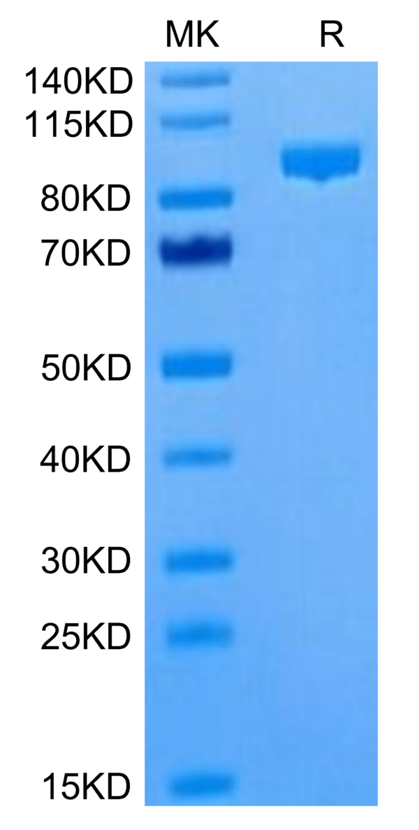 SDS-PAGE gel of Cynomolgus Complement Component C2 Protein 3072