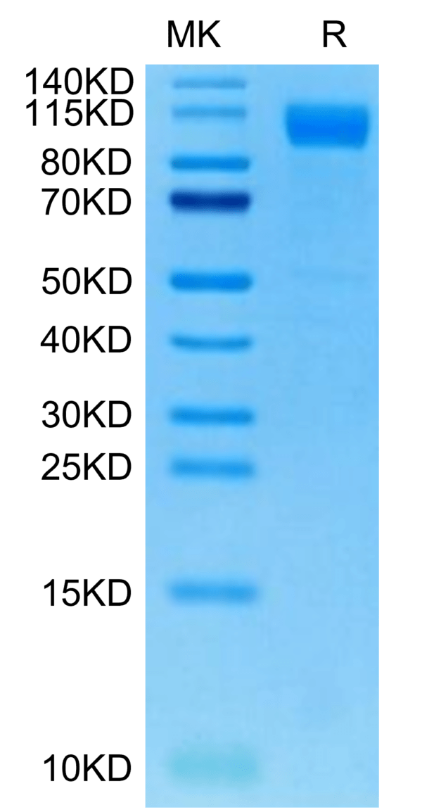 SDS-PAGE gel of SARS-COV-2 Spike S1 (Deltacron) Protein 3109