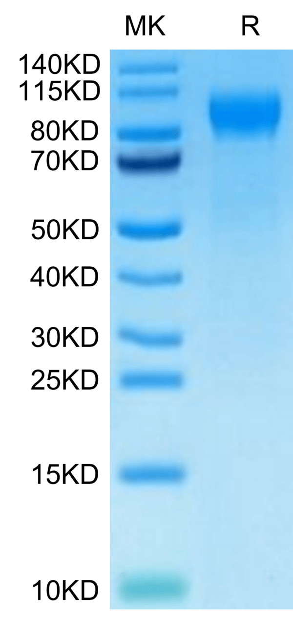 SDS-PAGE gel of Cynomolgus E-selectin/CD62E Protein 3111