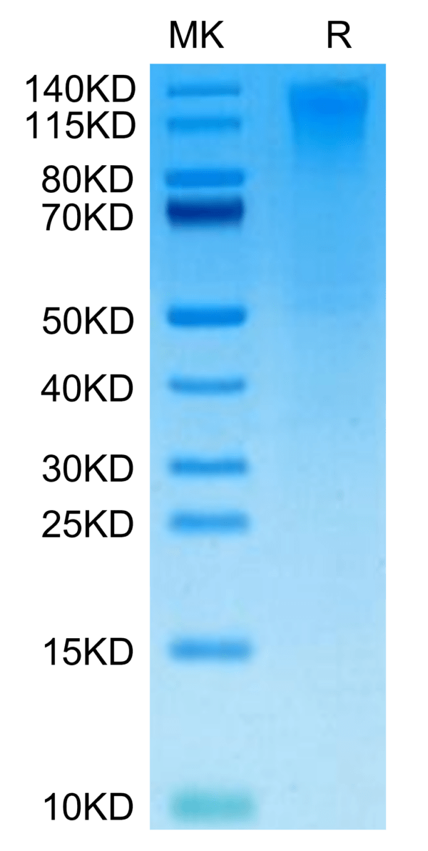 SDS-PAGE gel of Biotinylated Human CD96/TACTILE Protein 3113