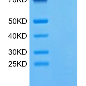 SDS-PAGE gel of Human CCL8 Protein 3114