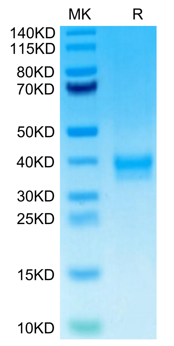 SDS-PAGE gel of Human ANTXR2 Protein 3127