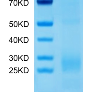 SDS-PAGE gel of Human MIF Protein 3145