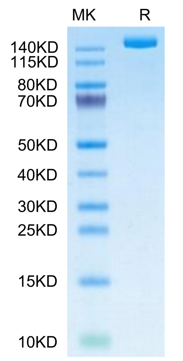 SDS-PAGE gel of SARS-COV-2 Spike S (B.1.640.2/IHU) Trimer Protein 3212