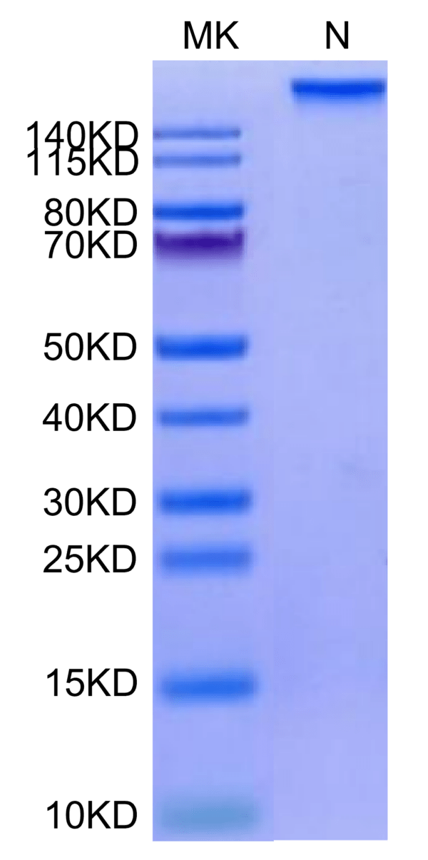 SDS-PAGE gel of Human HLA-A*02:01&B2M&HPV16 E7 (YMLDLQPET) Tetramer Pro 3252