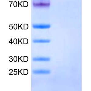 SDS-PAGE gel of Human Integrin alpha 1 beta 1 (ITGA1&ITGB1) Heterodimer 3272