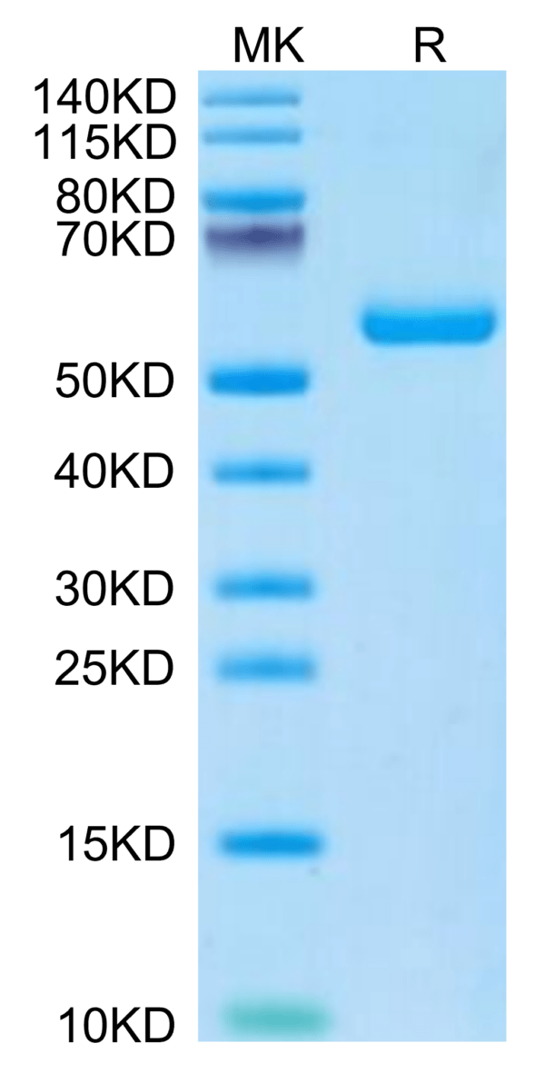 SDS-PAGE gel of Mouse TIMP1 Protein 3293