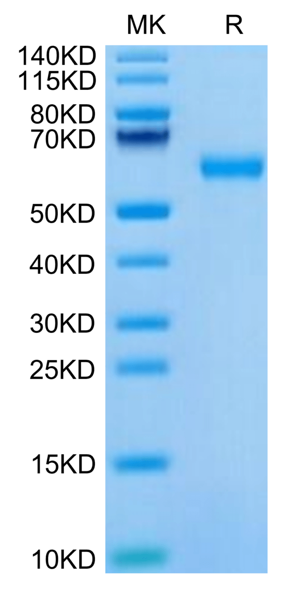 SDS-PAGE gel of Mouse ROR1 Protein 3303