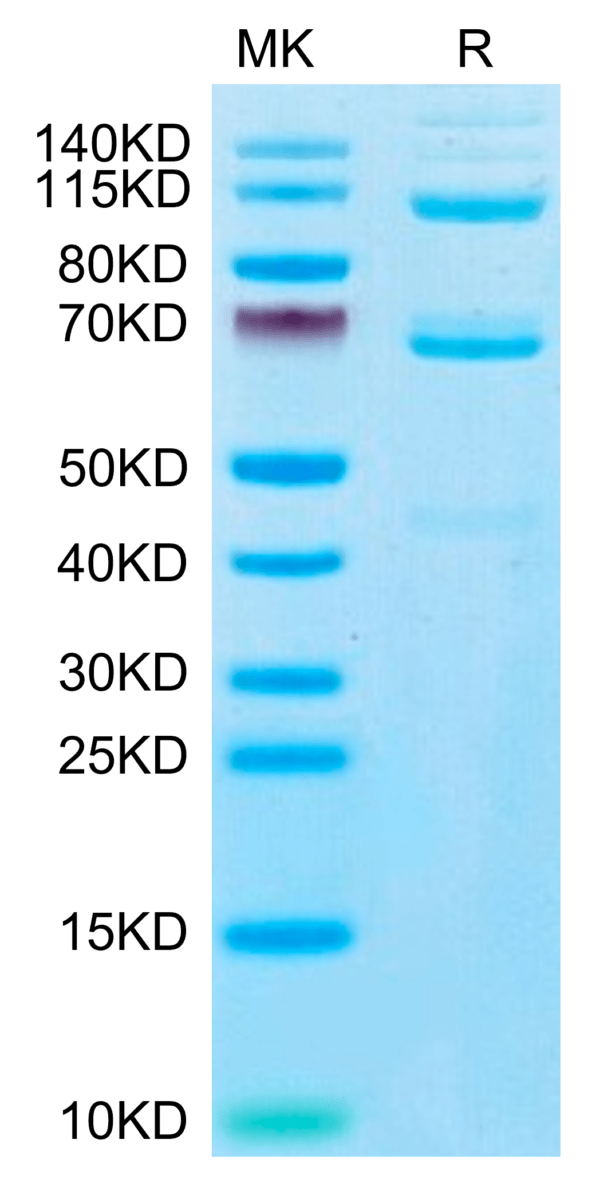 SDS-PAGE gel of Human Complement component 3 Protein 3318